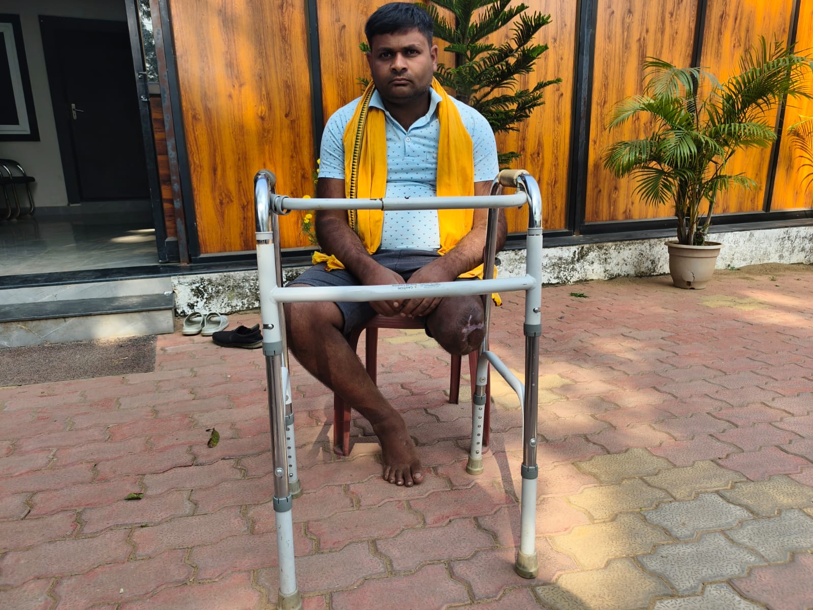 एक हादसे में अपना एक पैर गवां चुके पुरेन्द्र का रायपुर में लगेगा नया कृत्रिम पैर