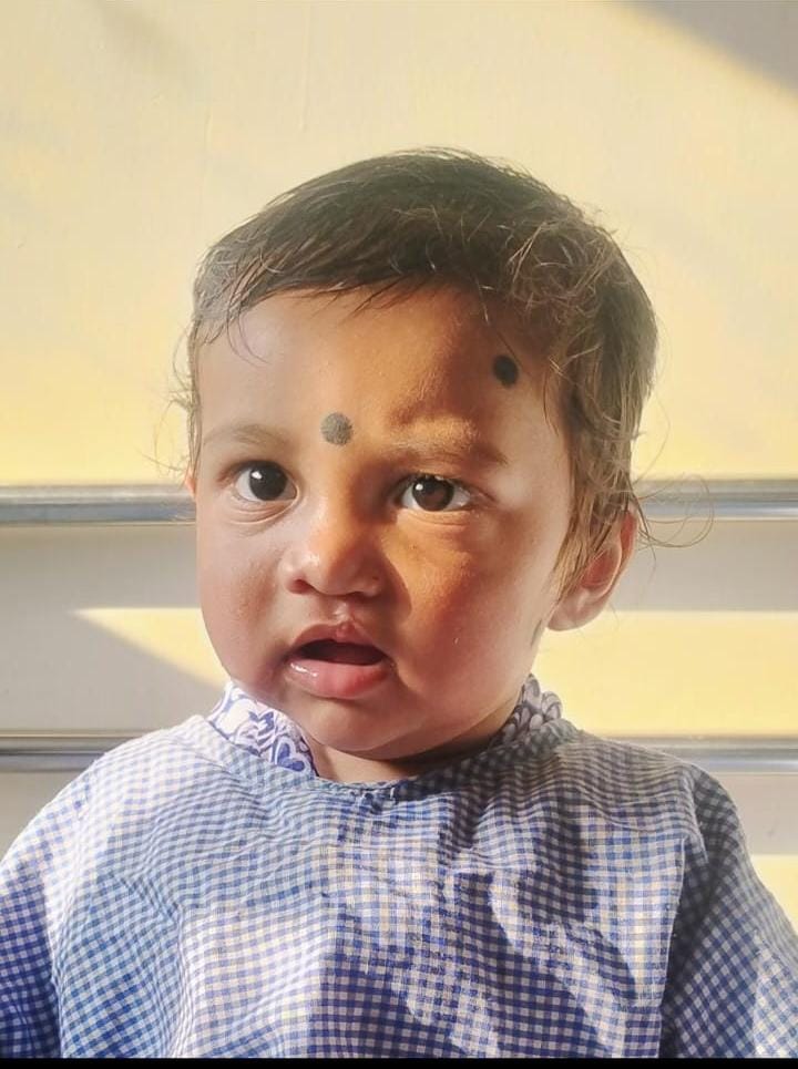 चिरायु से गर्वित को जन्मजात विकृति से मिली निजात